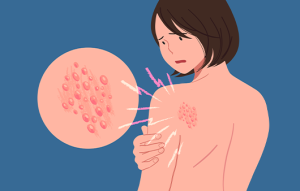 질병
