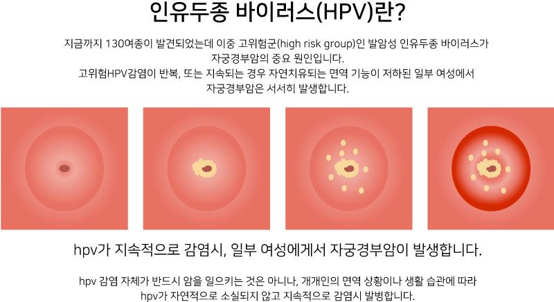 HPV 바이러스